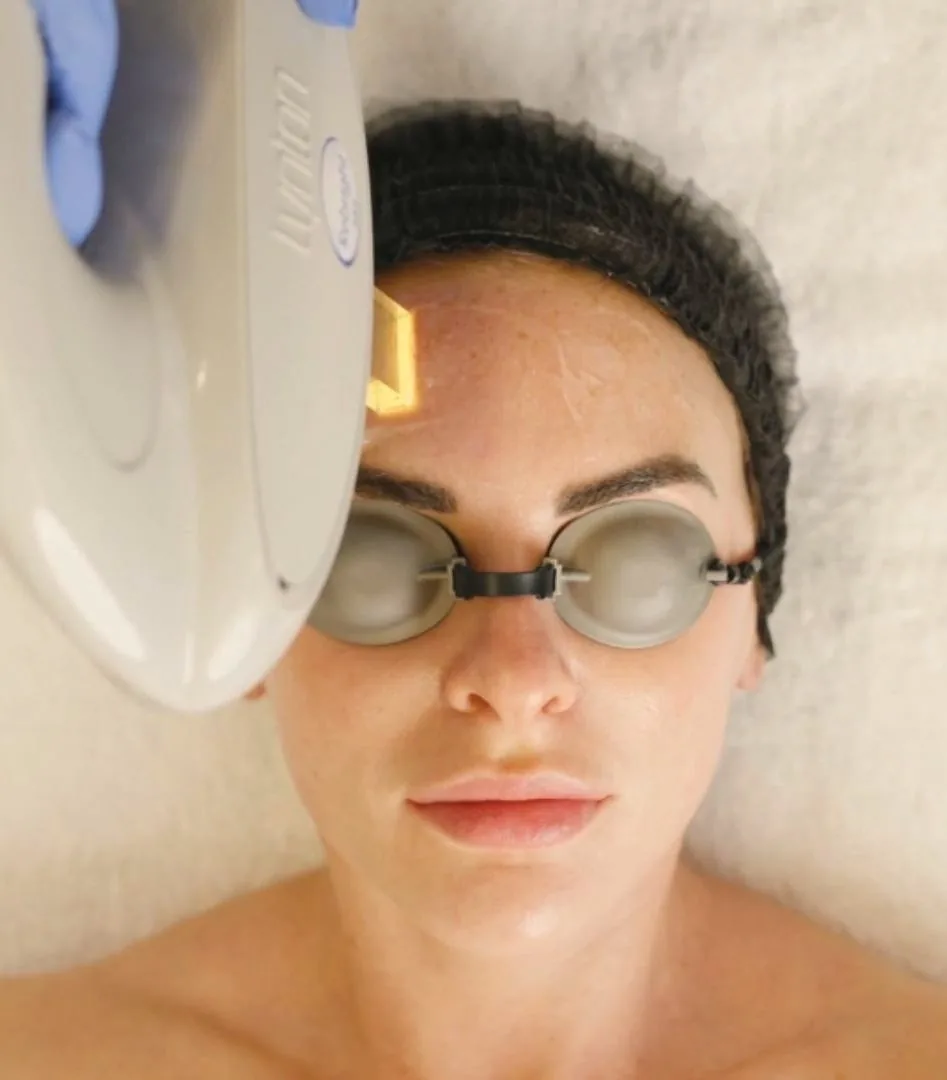 Step three of the Illumifacial: Lynton IPL delivered with the ReBright handpiece